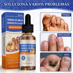 Sérum para Uñas con Veneno de Abeja 50ml – Tratamiento Antihongos y Cuidado Intensivo