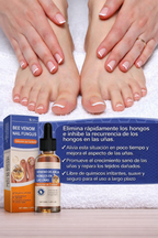 Sérum para Uñas con Veneno de Abeja 50ml – Tratamiento Antihongos y Cuidado Intensivo